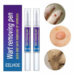 EELHOE Wart Removing Pen | Remove Moles, Skin Tags & Warts Quickly and Safely
