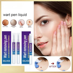 EELHOE Wart Removing Pen | Remove Moles, Skin Tags & Warts Quickly and Safely