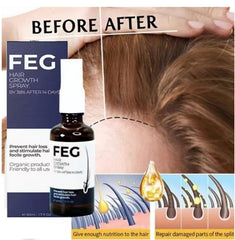FEG Plus Hair Growth Spray – Advanced Formula for Stronger, Thicker Hair